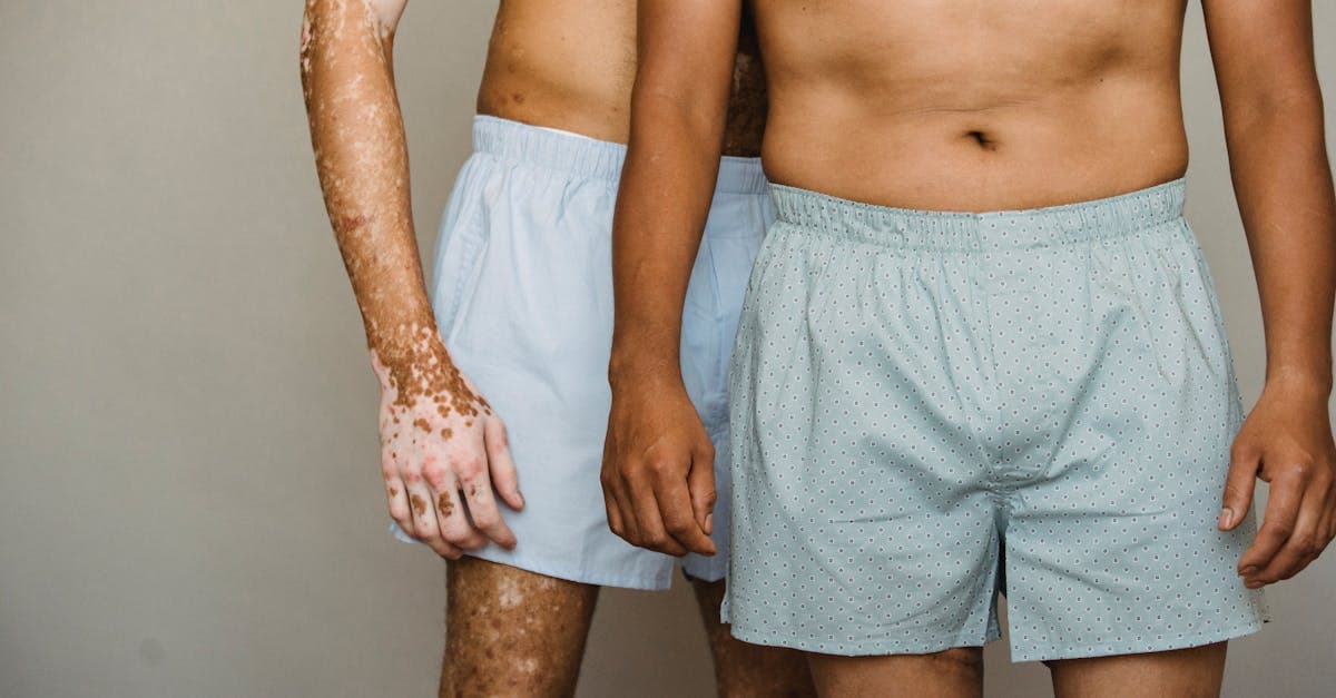 Cover image for The Ultimate Guide to Psoriasis: Explore Effective Remedies and Living Well